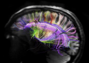 rainbow-brain-map-science-aaas